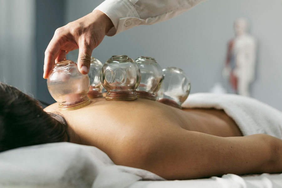 ventouse, osteopathe, bienfait ventouse, osteopathe, bienfait